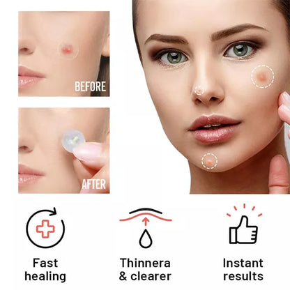 Acne Patch Day Night Repair
